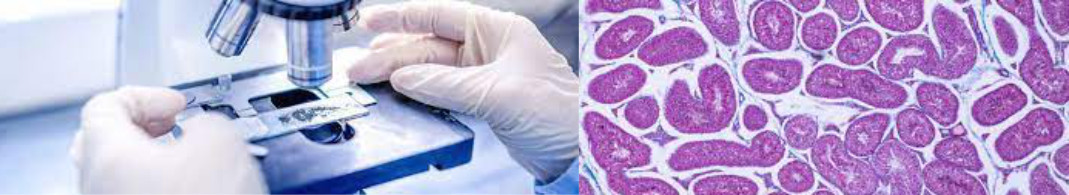 qsomos-anatomopatologico-centro