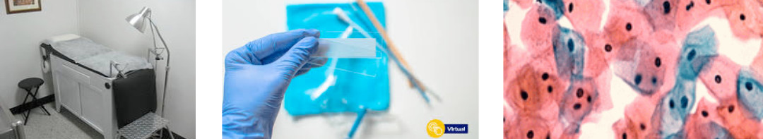 qsomos-citolog-cervicovaginal-centro