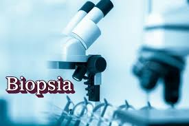 ¿Qué es una biopsia?